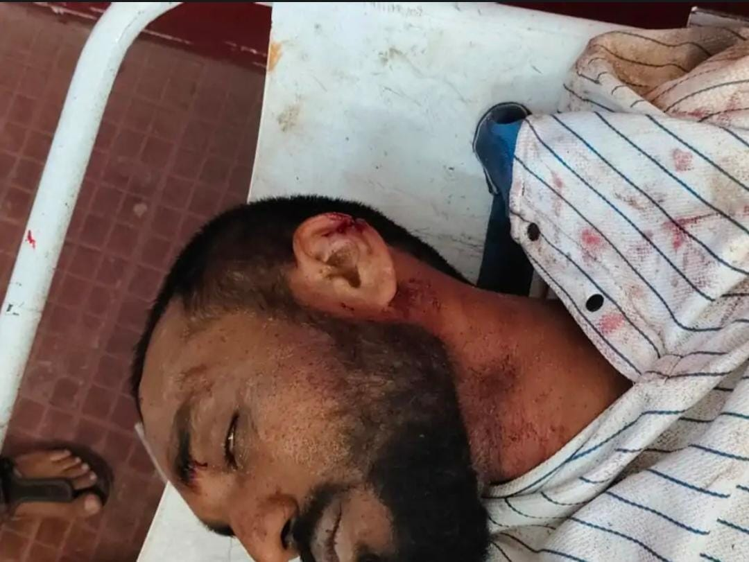 छत्तीसगढ़ के सरगुजा जिले से एक बेहद संवेदनशील मामला सामने आया है। यहां एक युवक के शव को दफनाने के बाद प्रशासन की मौजूदगी में कब्र खोदकर बाहर निकाला गया।