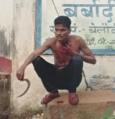हंसिया से खुद का गला काटकर बैठा रहा युवक, हाथ-पैर पर भी किए वार